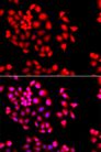 STXBP2 Antibody - Immunofluorescence analysis of A549 cells using STXBP2 antibody. Blue: DAPI for nuclear staining.