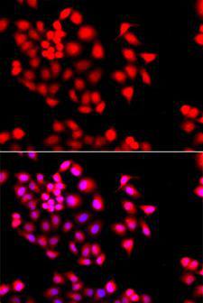STXBP2 Antibody - Immunofluorescence analysis of A549 cells using STXBP2 antibody. Blue: DAPI for nuclear staining.
