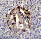 STXBP3 Antibody - STXBP3 Antibody immunohistochemistry of formalin-fixed and paraffin-embedded human pancreas tissue followed by peroxidase-conjugated secondary antibody and DAB staining.