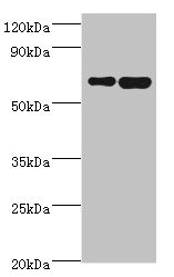 STXBP3 Antibody - Western blot All lanes: STXBP3 antibody at 10µg/ml Lane 1: HepG2 whole cell lysate Lane 2: K562 whole cell lysate Secondary Goat polyclonal to rabbit IgG at 1/10000 dilution Predicted band size: 68 kDa Observed band size: 68 kDa