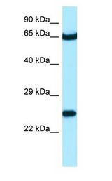STXBP3 Antibody - STXBP3 antibody Western Blot of NCI-H226.  This image was taken for the unconjugated form of this product. Other forms have not been tested.