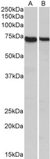 STXBP3 Antibody - Goat anti-MUNC18C Antibody (1µg/ml) staining of Mouse (A) and Rat (B) Spleen lysates (35µg protein in RIPA buffer). Primary incubation was 1 hour. Detected by chemiluminescencence.