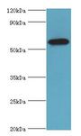STXBP4 Antibody - Western blot. All lanes: STXBP4 antibody at 10 ug/ml+PC-3 whole cell lysate. Secondary antibody: Goat polyclonal to rabbit at 1:10000 dilution. Predicted band size: 62 kDa. Observed band size: 62 kDa.