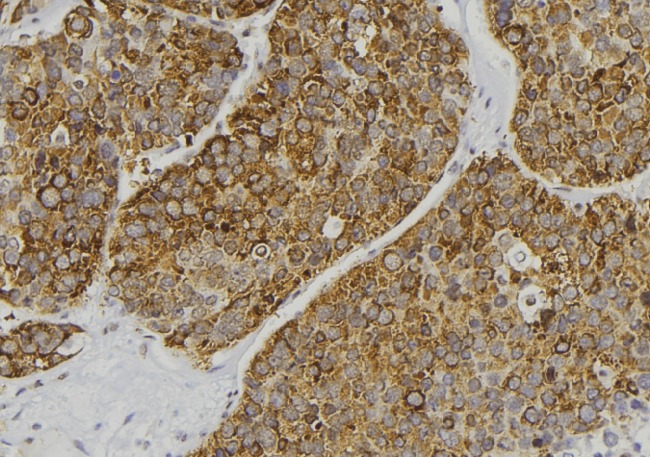 STXBP4 Antibody - 1:100 staining human pancreas tissue by IHC-P. The sample was formaldehyde fixed and a heat mediated antigen retrieval step in citrate buffer was performed. The sample was then blocked and incubated with the antibody for 1.5 hours at 22°C. An HRP conjugated goat anti-rabbit antibody was used as the secondary.