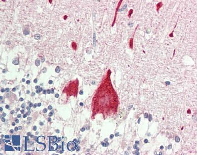 STYK1 Antibody - Human Brain, Cerebellum: Formalin-Fixed, Paraffin-Embedded (FFPE).  This image was taken for the unconjugated form of this product. Other forms have not been tested.