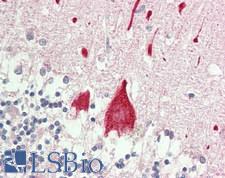STYK1 Antibody - Human Brain, Cerebellum: Formalin-Fixed, Paraffin-Embedded (FFPE).  This image was taken for the unconjugated form of this product. Other forms have not been tested.