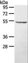 STYK1 Antibody - Western blot analysis of A431 cell, using STYK1 Polyclonal Antibody at dilution of 1:500.