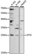 STYX Antibody - Western blot analysis of extracts of various cell lines, using STYX antibody at 1:1000 dilution. The secondary antibody used was an HRP Goat Anti-Rabbit IgG (H+L) at 1:10000 dilution. Lysates were loaded 25ug per lane and 3% nonfat dry milk in TBST was used for blocking. An ECL Kit was used for detection and the exposure time was 180s.