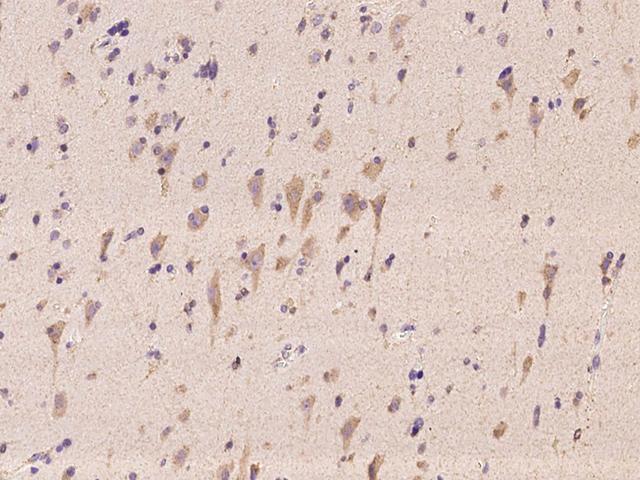 STYX Antibody - Immunochemical staining of human STYX in human brain with rabbit polyclonal antibody at 1:100 dilution, formalin-fixed paraffin embedded sections.