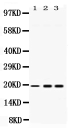 SUB1 Antibody - Western blot analysis of PC4 using anti-PC4 antibody. Electrophoresis was performed on a 5-20% SDS-PAGE gel at 70V (Stacking gel) / 90V (Resolving gel) for 2-3 hours. The sample well of each lane was loaded with 50ug of sample under reducing conditions. Lane 1: rat liver tissue lysates, Lane 2: Hela whole cell lysates, Lane 3: U2OS whole cell lysates. After Electrophoresis, proteins were transferred to a Nitrocellulose membrane at 150mA for 50-90 minutes. Blocked the membrane with 5% Non-fat Milk/ TBS for 1.5 hour at RT. The membrane was incubated with rabbit anti-PC4 antigen affinity purified polyclonal antibody at 0.5 µg/mL overnight at 4°C, then washed with TBS-0.1% Tween 3 times with 5 minutes each and probed with a goat anti-rabbit IgG-HRP secondary antibody at a dilution of 1:10000 for 1.5 hour at RT. The signal is developed using an Enhanced Chemiluminescent detection (ECL) kit with Tanon 5200 system. A specific band was detected for PC4 at approximately 19KD. The expected band size for PC4 is at 19KD.