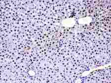 SUB1 Antibody - IHC analysis of PC4 using anti-PC4 antibody. PC4 was detected in paraffin-embedded section of rat liver tissues. Heat mediated antigen retrieval was performed in citrate buffer (pH6, epitope retrieval solution) for 20 mins. The tissue section was blocked with 10% goat serum. The tissue section was then incubated with 1µg/ml rabbit anti-PC4 Antibody overnight at 4°C. Biotinylated goat anti-rabbit IgG was used as secondary antibody and incubated for 30 minutes at 37°C. The tissue section was developed using Strepavidin-Biotin-Complex (SABC) with DAB as the chromogen.