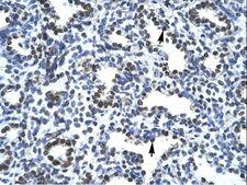 SUB1 Antibody - SUB1 antibody P100959_T100-NP_006704-PC4 Antibody was used in IHC to stain formalin-fixed, paraffin-embedded human lung.  This image was taken for the unconjugated form of this product. Other forms have not been tested.