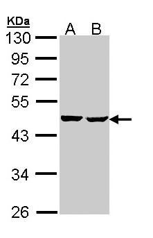 SUCLA2 Antibody - Sample (30 ug of whole cell lysate). A: Hep G2 , B: Molt-4 . 10% SDS PAGE. SUCLA2 antibody diluted at 1:1000.