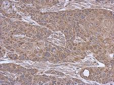 SUCLA2 Antibody - IHC of paraffin-embedded Cal27 xenograft using SUCLA2 antibody at 1:500 dilution.