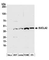 SUCLA2 Antibody - Detection of human and mouse SUCLA2 by western blot. Samples: Whole cell lysate (50 µg) from HeLa, HEK293T, Jurkat, mouse TCMK-1, and mouse NIH 3T3 cells prepared using NETN lysis buffer. Antibody: Affinity purified rabbit anti-SUCLA2 antibody used for WB at 0.1 µg/ml. Detection: Chemiluminescence with an exposure time of 30 seconds.