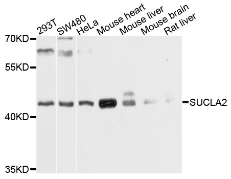 SUCLA2 Antibody - Western blot analysis of extracts of various cell lines, using SUCLA2 antibody at 1:1000 dilution. The secondary antibody used was an HRP Goat Anti-Rabbit IgG (H+L) at 1:10000 dilution. Lysates were loaded 25ug per lane and 3% nonfat dry milk in TBST was used for blocking. An ECL Kit was used for detection and the exposure time was 1s.
