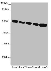 SUCLA2 Antibody - Western blot All Lanes: SUCLA2 antibody at 1.75 ug/ml Lane 1: Hela whole cell lysate Lane 2: Jurkat whole cell lysate Lane 3: A549 whole cell lysate Lane 4: 293T whole cell lysate Lane 5: HepG-2 whole cell lysate Secondary Goat polyclonal to rabbit IgG at 1/10000 dilution Predicted band size: 51,49 kDa Observed band size: 50 kDa