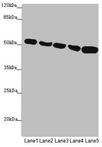 SUCLA2 Antibody - Western blot All lanes: SUCLA2 antibody at 1.75µg/ml Lane 1: Hela whole cell lysate Lane 2: Jurkat whole cell lysate Lane 3: A549 whole cell lysate Lane 4: 293T whole cell lysate Lane 5: HepG2 whole cell lysate Secondary Goat polyclonal to rabbit IgG at 1/10000 dilution Predicted band size: 51, 49 kDa Observed band size: 51 kDa