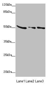 SUCLA2 Antibody - Western blot All Lanes: SUCLA2 antibody at 0.85 ug/ml Lane 1: Rat heart tissue Lane 2: Hela whole cell lysate Lane 3: A549 whole cell lysate Secondary Goat polyclonal to rabbit IgG at 1/10000 dilution Predicted band size: 51,49 kDa Observed band size: 50 kDa