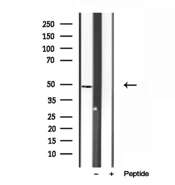 SUCLA2 Antibody - Western blot analysis of extracts of PC-3 cells using SUCLA2 antibody.