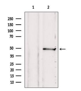 SUCLA2 Antibody - Western blot analysis of extracts of 293 cells using SUCLA2 antibody. Lane 1 was treated with the blocking peptide.