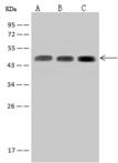 SUCLA2 Antibody - Anti-SUCLA2 rabbit polyclonal antibody at 1:500 dilution. Lane A: HepG2 Whole Cell Lysate. Lane B: MOLT-4 Whole Cell Lysate. Lane C: U-251 MG Whole Cell Lysate. Lysates/proteins at 30 ug per lane. Secondary: Goat Anti-Rabbit IgG (H+L)/HRP at 1/10000 dilution. Developed using the ECL technique. Performed under reducing conditions. Predicted band size: 50 kDa. Observed band size: 45 kDa.