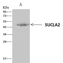 SUCLA2 Antibody - SUCLA2 was immunoprecipitated using: Lane A: 0.5 mg Mouse kidney Whole Cell Lysate. 4 uL anti-SUCLA2 rabbit polyclonal antibody and 60 ug of Immunomagnetic beads Protein A/G. Primary antibody: Anti-SUCLA2 rabbit polyclonal antibody, at 1:100 dilution. Secondary antibody: Clean-Blot IP Detection Reagent (HRP) at 1:1000 dilution. Developed using the ECL technique. Performed under reducing conditions. Predicted band size: 50 kDa. Observed band size: 50 kDa.