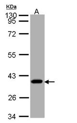 SUCLG1 / GALPHA Antibody - Sample (30 ug of whole cell lysate). A: A431. 10% SDS PAGE. SUCLG1 / GALPHA antibody diluted at 1:1000