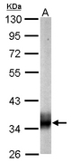 SUCLG1 / GALPHA Antibody - Sample (20 ug of whole cell lysate). A: mouse brain. 10% SDS PAGE. SUCLG1 / GALPHA antibody diluted at 1:10000.