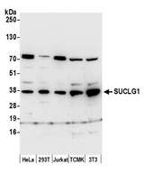 SUCLG1 / GALPHA Antibody - Detection of human and mouse SUCLG1 by western blot. Samples: Whole cell lysate (50 µg) from HeLa, HEK293T, Jurkat, mouse TCMK-1, and mouse NIH 3T3 cells prepared using NETN lysis buffer. Antibody: Affinity purified rabbit anti-SUCLG1 antibody used for WB at 0.4 µg/ml. Detection: Chemiluminescence with an exposure time of 30 seconds.