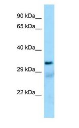 SUCLG1 / GALPHA Antibody - SUCLG1 / GALPHA antibody Western Blot of Human Lung.  This image was taken for the unconjugated form of this product. Other forms have not been tested.