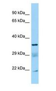SUCLG1 / GALPHA Antibody - SUCLG1 / GALPHA antibody Western Blot of U937.  This image was taken for the unconjugated form of this product. Other forms have not been tested.