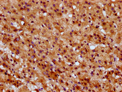 SUCLG1 / GALPHA Antibody - Immunohistochemistry Dilution at 1:600 and staining in paraffin-embedded human adrenal gland tissue performed on a Leica BondTM system. After dewaxing and hydration, antigen retrieval was mediated by high pressure in a citrate buffer (pH 6.0). Section was blocked with 10% normal Goat serum 30min at RT. Then primary antibody (1% BSA) was incubated at 4°C overnight. The primary is detected by a biotinylated Secondary antibody and visualized using an HRP conjugated SP system.