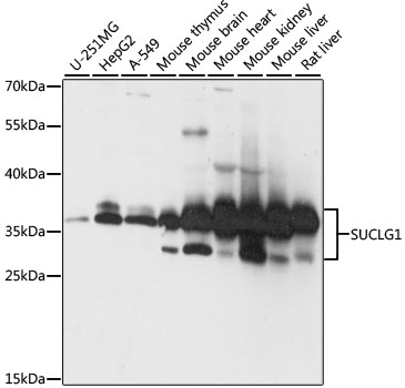 SUCLG1 / GALPHA Antibody - Western blot analysis of extracts of various cell lines, using SUCLG1 antibody at 1:1000 dilution. The secondary antibody used was an HRP Goat Anti-Rabbit IgG (H+L) at 1:10000 dilution. Lysates were loaded 25ug per lane and 3% nonfat dry milk in TBST was used for blocking. An ECL Kit was used for detection and the exposure time was 5s.