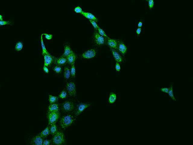 SUCLG1 / GALPHA Antibody - Immunofluorescence staining of SUCLG1 in A431 cells. Cells were fixed with 4% PFA, permeabilzed with 0.1% Triton X-100 in PBS, blocked with 10% serum, and incubated with rabbit anti-Human SUCLG1 polyclonal antibody (dilution ratio 1:200) at 4°C overnight. Then cells were stained with the Alexa Fluor 488-conjugated Goat Anti-rabbit IgG secondary antibody (green) and counterstained with DAPI (blue). Positive staining was localized to Cytoplasm.