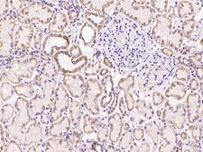 SUCLG1 / GALPHA Antibody - Immunochemical staining of human SUCLG1 in human kidney with rabbit polyclonal antibody at 1:100 dilution, formalin-fixed paraffin embedded sections.
