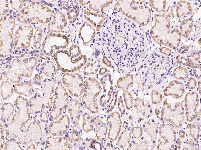 SUCLG1 / GALPHA Antibody - Immunochemical staining of human SUCLG1 in human kidney with rabbit polyclonal antibody at 1:100 dilution, formalin-fixed paraffin embedded sections.