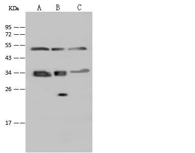 SUCLG1 / GALPHA Antibody - Anti-SUCLG1 rabbit polyclonal antibody at 1:500 dilution. Lane A: A431 Whole Cell Lysate. Lane B: U-251 MG Whole Cell Lysate. Lane C: NIH-3T3 Whole Cell Lysate. Lysates/proteins at 30 ug per lane. Secondary: Goat Anti-Rabbit IgG (H+L)/HRP at 1/10000 dilution. Developed using the ECL technique. Performed under reducing conditions. Predicted band size: 36 kDa.