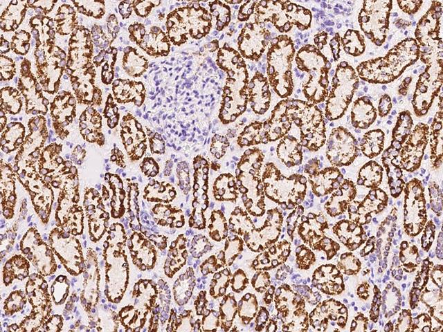SUCLG1 / GALPHA Antibody - Immunochemical staining SUCLG1 in human kidney with rabbit polyclonal antibody at 1:1000 dilution, formalin-fixed paraffin embedded sections.