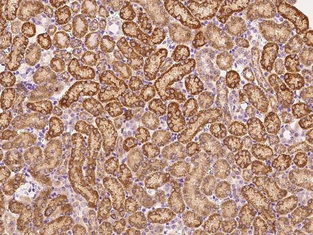 SUCLG1 / GALPHA Antibody - Immunochemical staining SUCLG1 in mouse kidney with rabbit polyclonal antibody at 1:1000 dilution, formalin-fixed paraffin embedded sections.