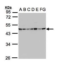 SUCLG2 Antibody - Sample (30g whole cell lysate). A:293T, B: A431 , C: H1299, D: HeLa S3 , E: Hep G2 . F: MOLT4 . G: Raji . 10% SDS PAGE. SUCLG2 antibody diluted at 1:1000