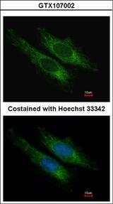 SUCLG2 Antibody - Immunofluorescence of methanol-fixed HeLa using SUCLG2 antibody at 1:200 dilution.