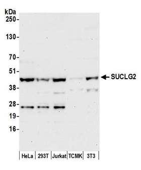 SUCLG2 Antibody - Detection of human and mouse SUCLG2 by western blot. Samples: Whole cell lysate (50 µg) from HeLa, HEK293T, Jurkat, mouse TCMK-1, and mouse NIH 3T3 cells prepared using NETN lysis buffer. Antibody: Affinity purified rabbit anti-SUCLG2 antibody used for WB at 0.4 µg/ml. Detection: Chemiluminescence with an exposure time of 30 seconds.
