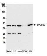 SUCLG2 Antibody - Detection of human and mouse SUCLG2 by western blot. Samples: Whole cell lysate (50 µg) from HeLa, HEK293T, Jurkat, mouse TCMK-1, and mouse NIH 3T3 cells prepared using NETN lysis buffer. Antibody: Affinity purified rabbit anti-SUCLG2 antibody used for WB at 0.4 µg/ml. Detection: Chemiluminescence with an exposure time of 30 seconds.