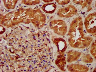 SUCLG2 Antibody - Immunohistochemistry image at a dilution of 1:300 and staining in paraffin-embedded human kidney tissue performed on a Leica BondTM system. After dewaxing and hydration, antigen retrieval was mediated by high pressure in a citrate buffer (pH 6.0) . Section was blocked with 10% normal goat serum 30min at RT. Then primary antibody (1% BSA) was incubated at 4 °C overnight. The primary is detected by a biotinylated secondary antibody and visualized using an HRP conjugated SP system.