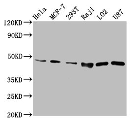 SUCLG2 Antibody - Positive Western Blot detected in Hela whole cell lysate, MCF-7 whole cell lysate, 293T whole cell lysate, Raji whole cell lysate, LO2 whole cell lysate, U87 whole cell lysate, . All lanes: SUCLG2 antibody at 6.7 µg/ml Secondary Goat polyclonal to rabbit IgG at 1/50000 dilution. Predicted band size: 47, 48 KDa. Observed band size: 47 KDa