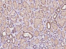 SUCLG2 Antibody - Immunochemical staining of human SUCLG2 in human kidney with rabbit polyclonal antibody at 1:100 dilution, formalin-fixed paraffin embedded sections.
