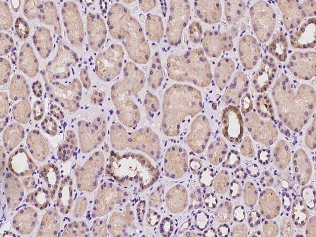 SUCLG2 Antibody - Immunochemical staining of human SUCLG2 in human kidney with rabbit polyclonal antibody at 1:100 dilution, formalin-fixed paraffin embedded sections.