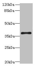 SUCNR1 / GPR91 Antibody - Western blot All lanes: SUCNR1 antibody at 6µg/ml Lane 1: Mouse lung tissue Lane 2: HL60 whole cell lysate Lane 3: Mouse spleen tissue Lane 4: Mouse heart tissue Lane 5: Hela whole cell lysate Lane 6: MCF-7 whole cell lysate Secondary Goat polyclonal to rabbit IgG at 1/10000 dilution Predicted band size: 39 kDa Observed band size: 39 kDa