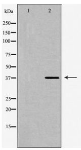 SUCNR1 / GPR91 Antibody - Western blot of SUCNR1 expression in HUVEC cells